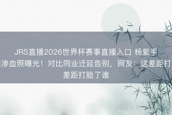 JRS直播2026世界杯赛事直播入口 杨紫手背冻裂渗血照曝光!对比同业迁延告别,网友:这差距打脸了谁